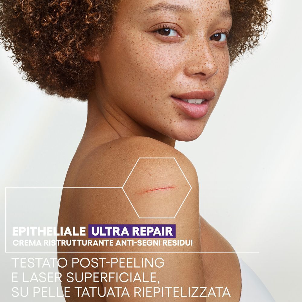 Donna con cicatrice sulla spalla, che illustra l'azione riparatrice della crema.