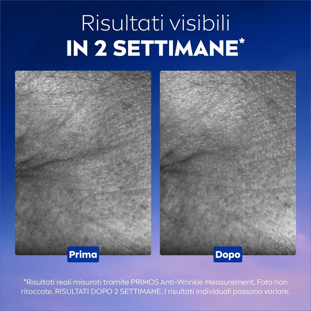 Confronto prima e dopo della pelle dopo l'uso di Nivea Cellular Epigenetics Siero Ringiovanente.