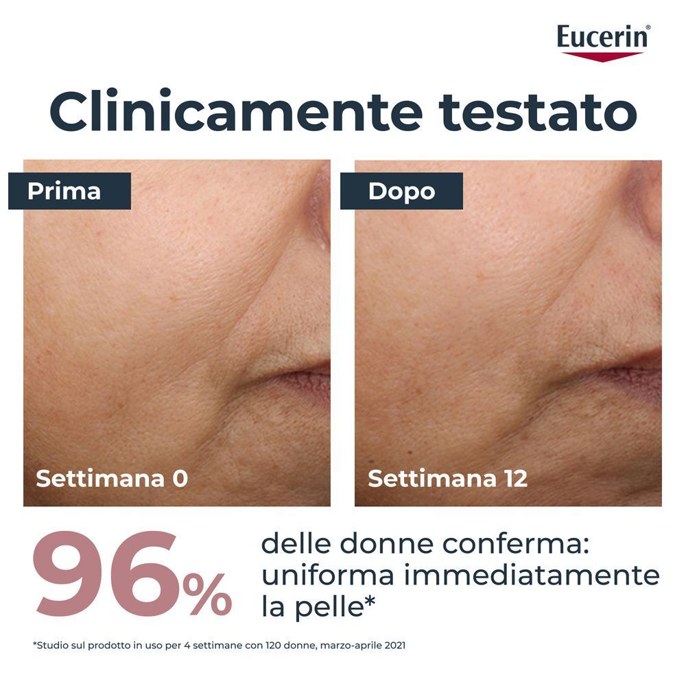 Confronto prima/dopo di Eucerin Anti-Pigment Crema Giorno SPF 30 Colorata Light. Il 96% delle donne conferma.