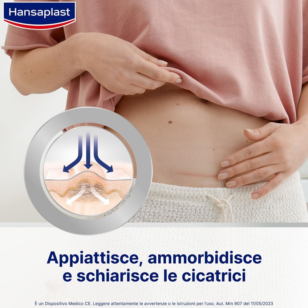 Hansaplast Riduzione Cicatrici XL: Agisce sul tessuto cicatriziale per appiattirlo e ammorbidirlo.