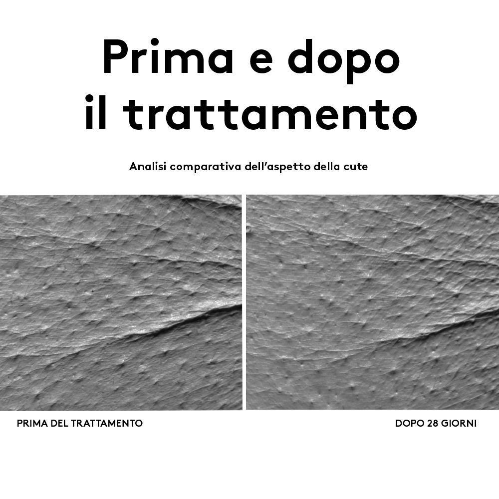 Confronto pelle prima e dopo 28 giorni di trattamento.