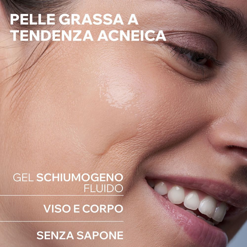 Primo piano di una pelle grassa a tendenza acneica.