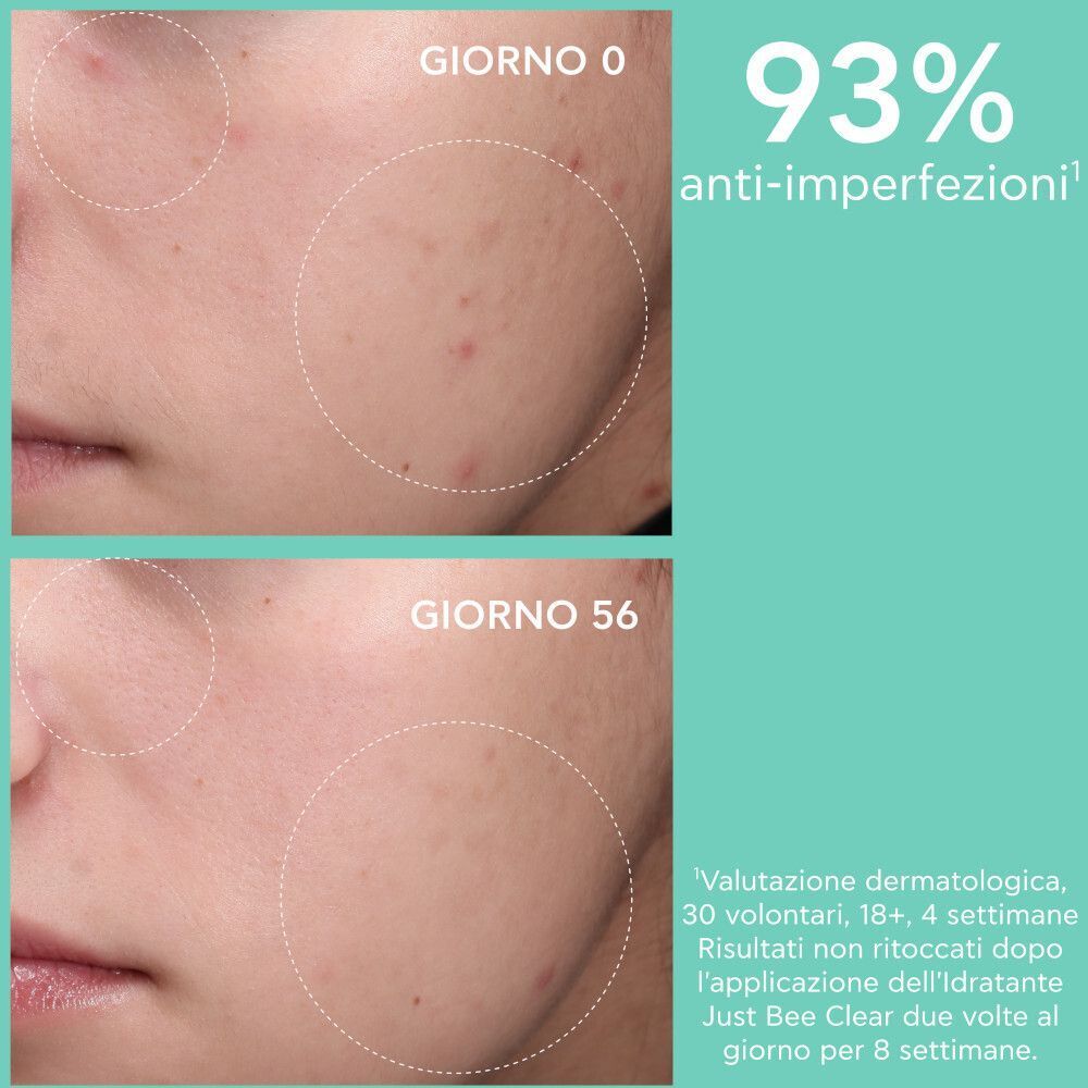 Confronto prima e dopo della pelle con crema Apivita Just Bee Clear.