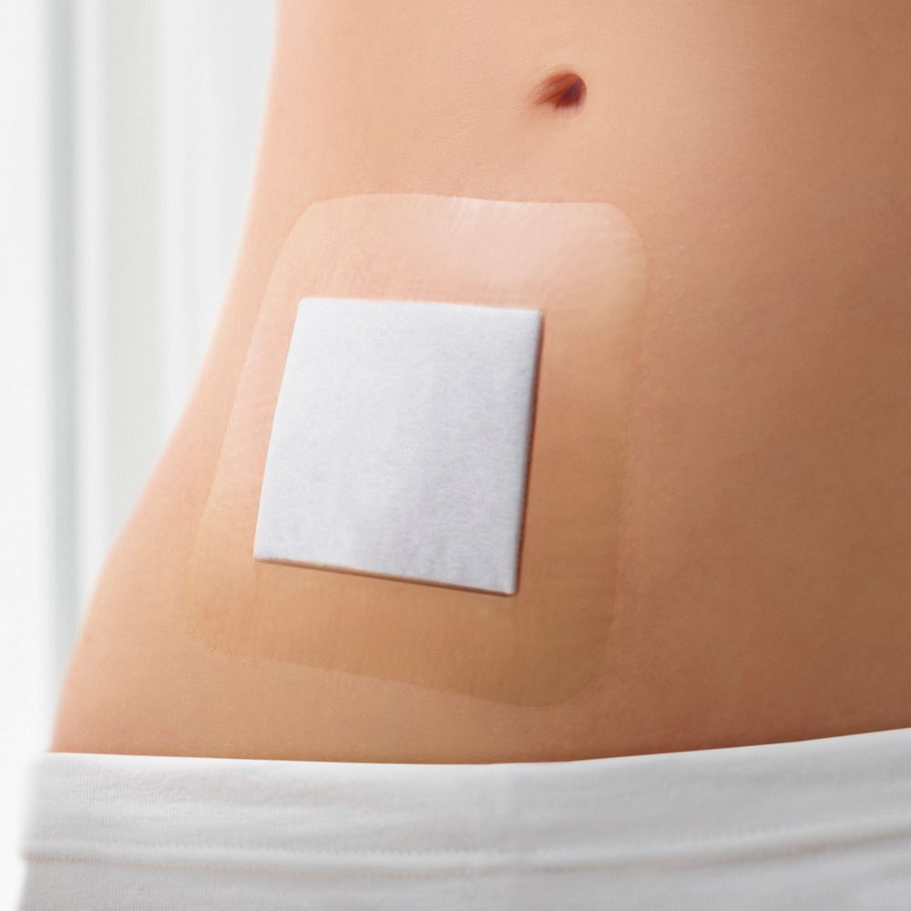 Persona con medicazione sull'addome. La medicazione trasparente copre la pelle. Un tampone bianco è visibile.