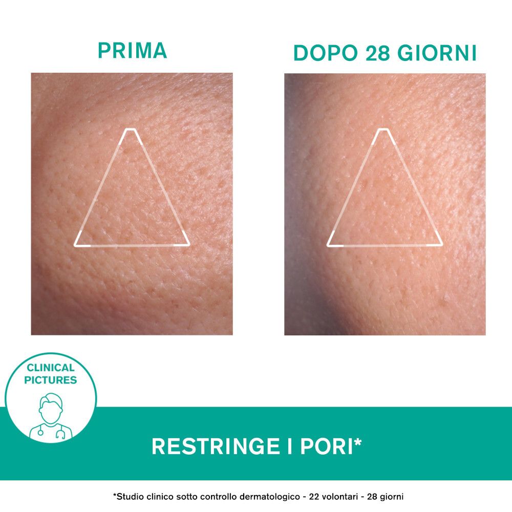 Confronto prima-dopo della pelle. Testo: Restringe i pori. Immagini cliniche.