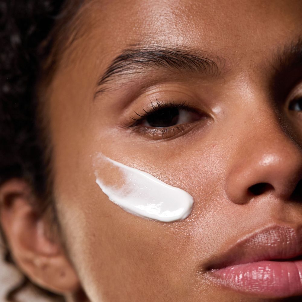 Viso di una persona con crema bianca sulla pelle. Applicazione di crema sulla guancia.