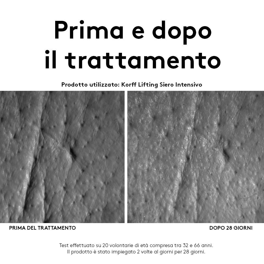 KORFF Lifting Siero Intensivo Effetto Lifting