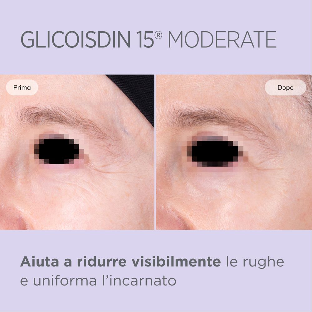 Confronto prima-dopo: contorno occhi. Testo: Aiuta a ridurre visibilmente le rughe e uniformare l'incarnato.