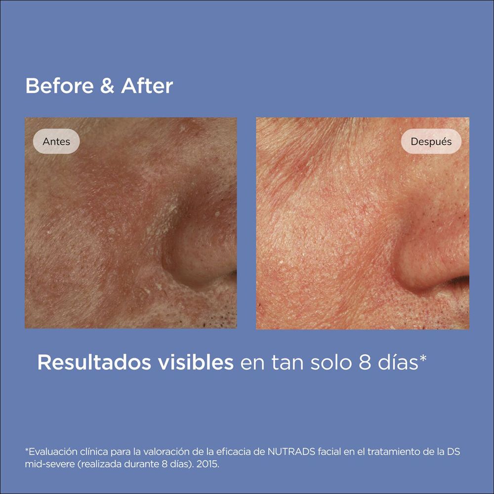 ISDIN Nutradeica Gel Crema Viso 50ml