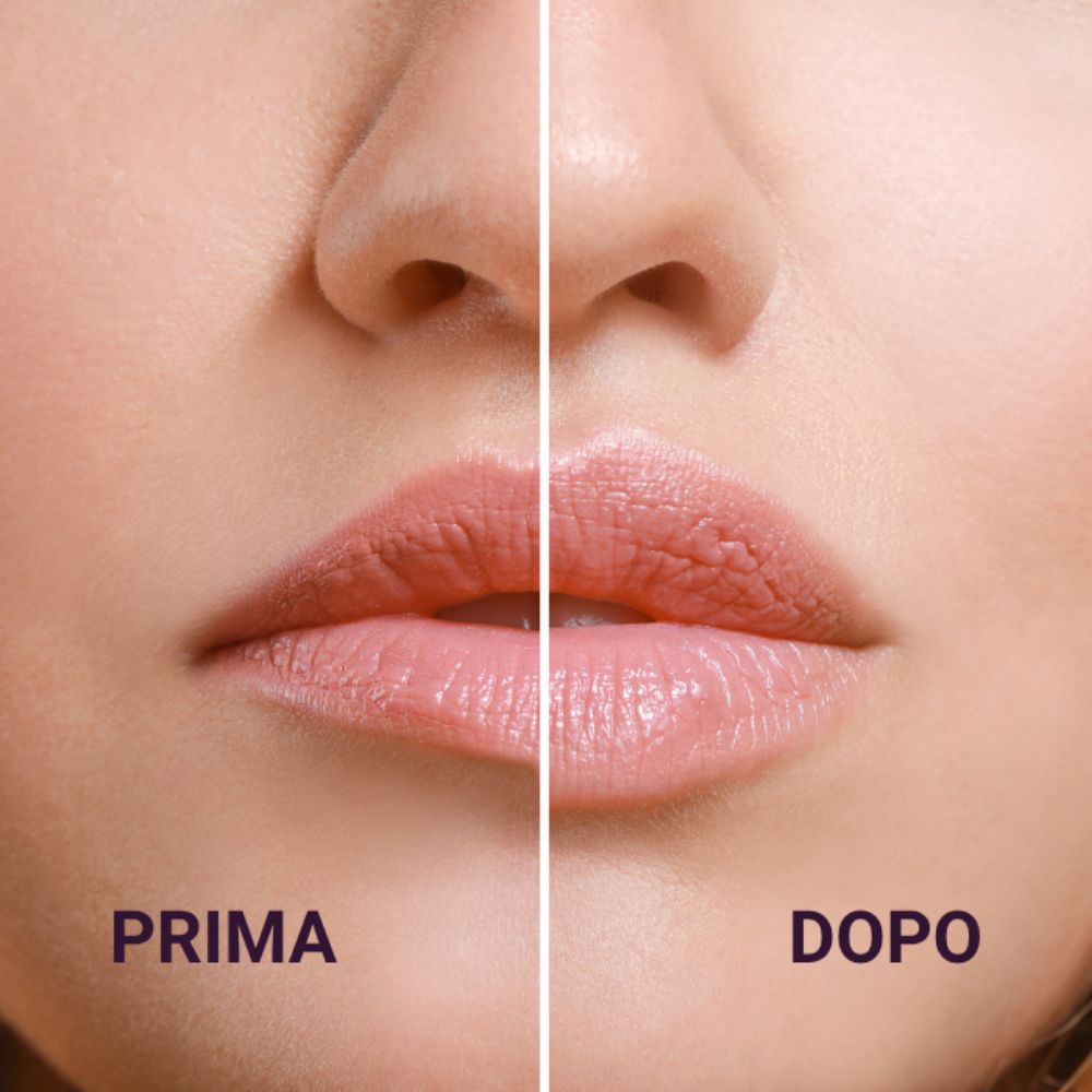Primo piano delle labbra. A sinistra: Prima. A destra: Dopo. Scritte PRIMA e DOPO.
