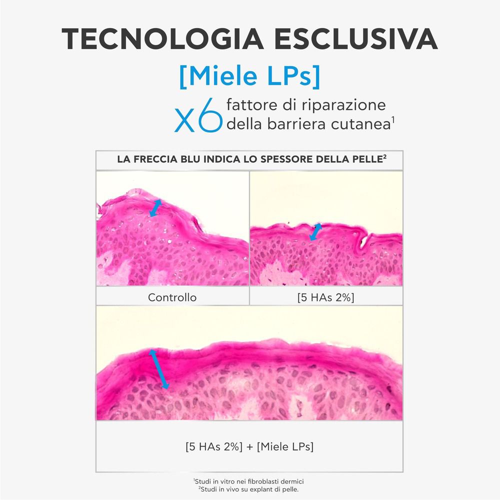 Immagini microscopiche della pelle. Testo: Tecnologia Esclusiva [Miele LPS]. Frecce blu indicano lo spessore della pelle.