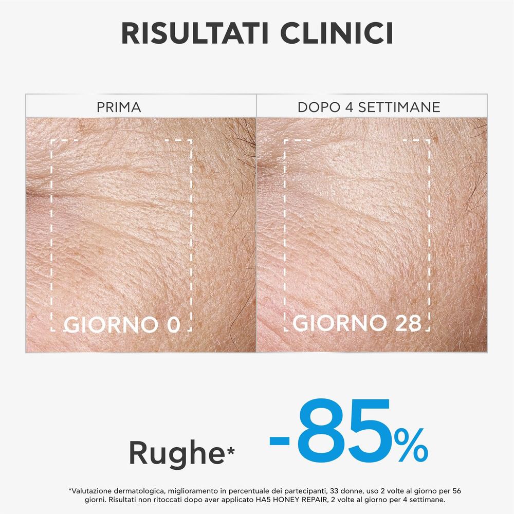Immagine prima-dopo. Testo: Risultati Clinici. Riduzione delle rughe dopo 4 settimane. Grafico con -85%.