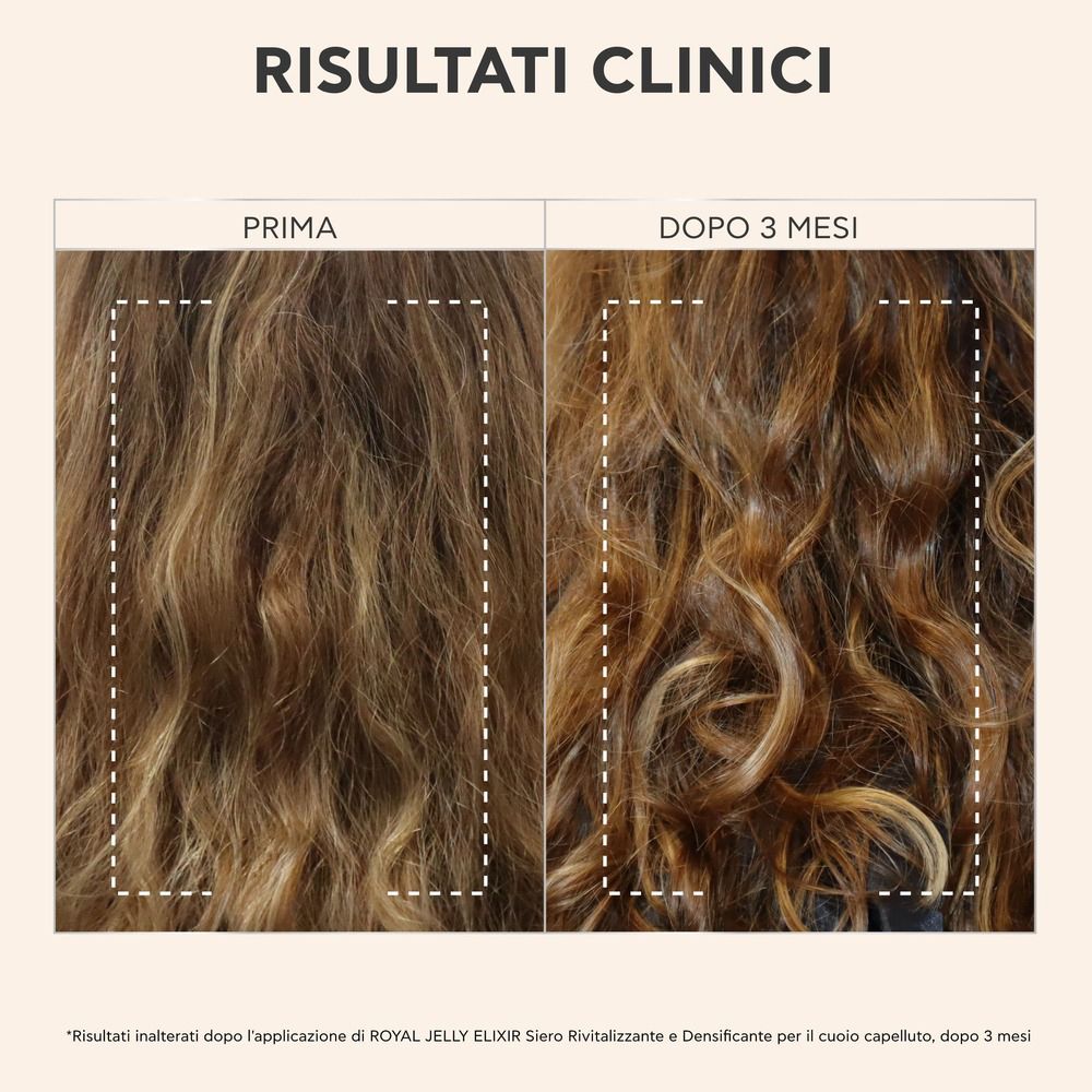 Immagine prima-dopo dei capelli. Testo: Risultati dopo 3 mesi. Capelli più folti.