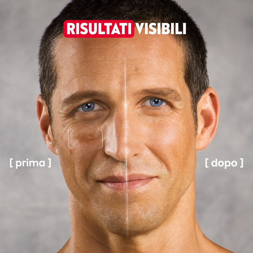 Viso di un uomo. Confronto prima-dopo. Pelle con macchie. Testo: Risultati Visibili.