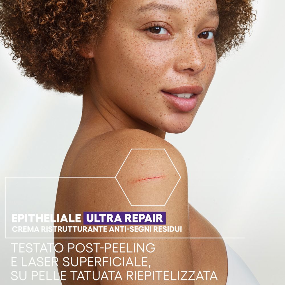 Donna con pelle. Testo: Epitheliale Ultra Repair, Crème Ristrutturante Anti-Segni Residui. Testato post-peeling.
