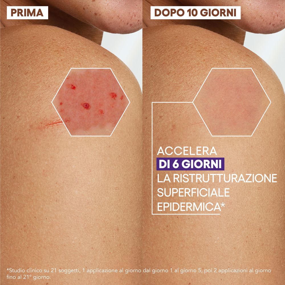 Immagine comparativa: pelle prima e dopo 10 giorni. Testo: Accelera la ristrutturazione epidermica in 6 giorni.