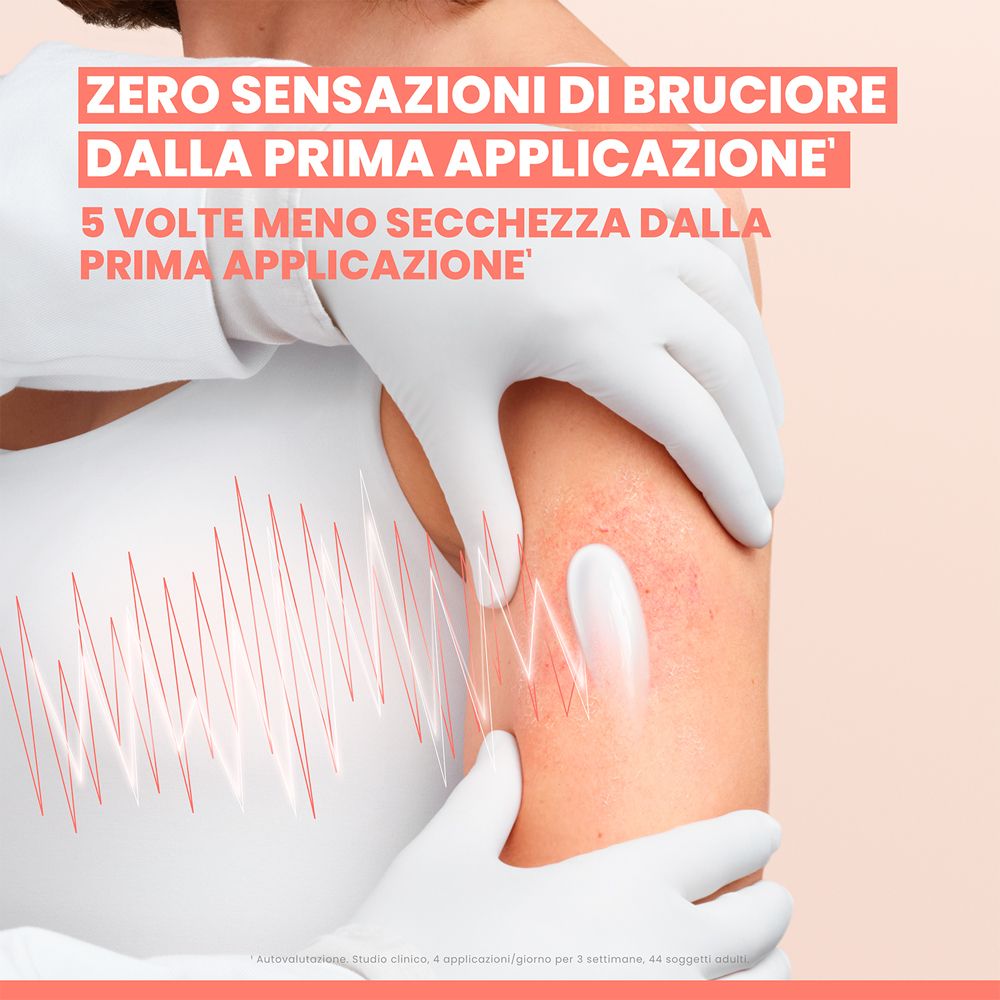 Pelle con eruzione cutanea rossa, su cui guanti bianchi applicano una crema. Linee ondulate grafiche indicano irritazione.
