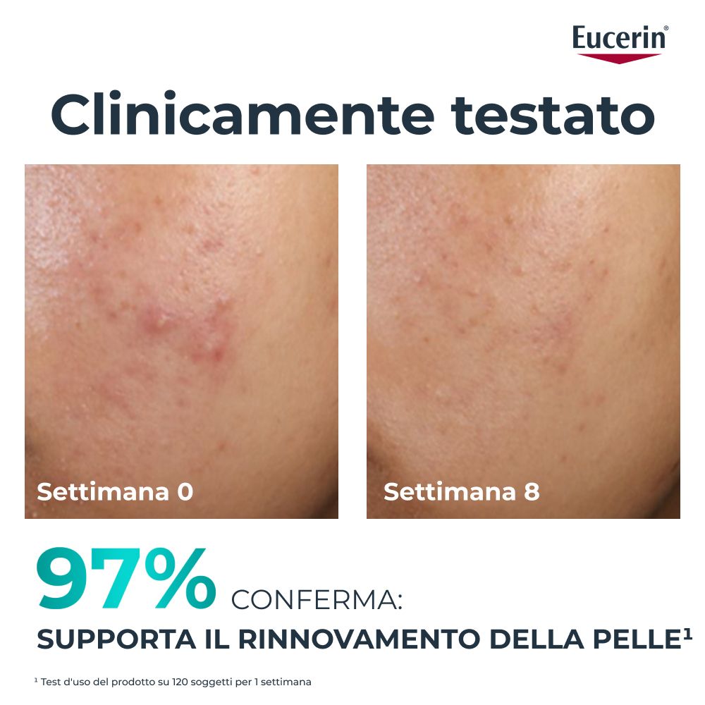 Viso con imperfezioni. Confronto prima-dopo. Testo: Clinicamente testato. Il 97% conferma il rinnovamento della pelle.