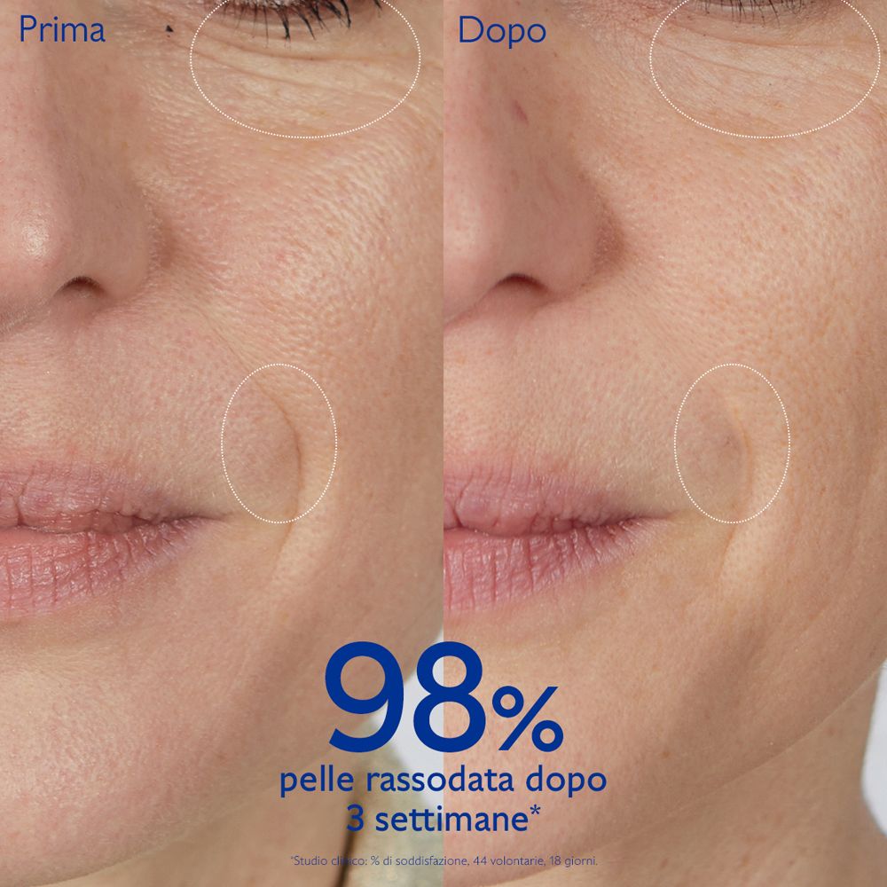 Confronto prima-dopo. Viso con rughe. Testo: 98% pelle rassodata dopo 3 settimane.