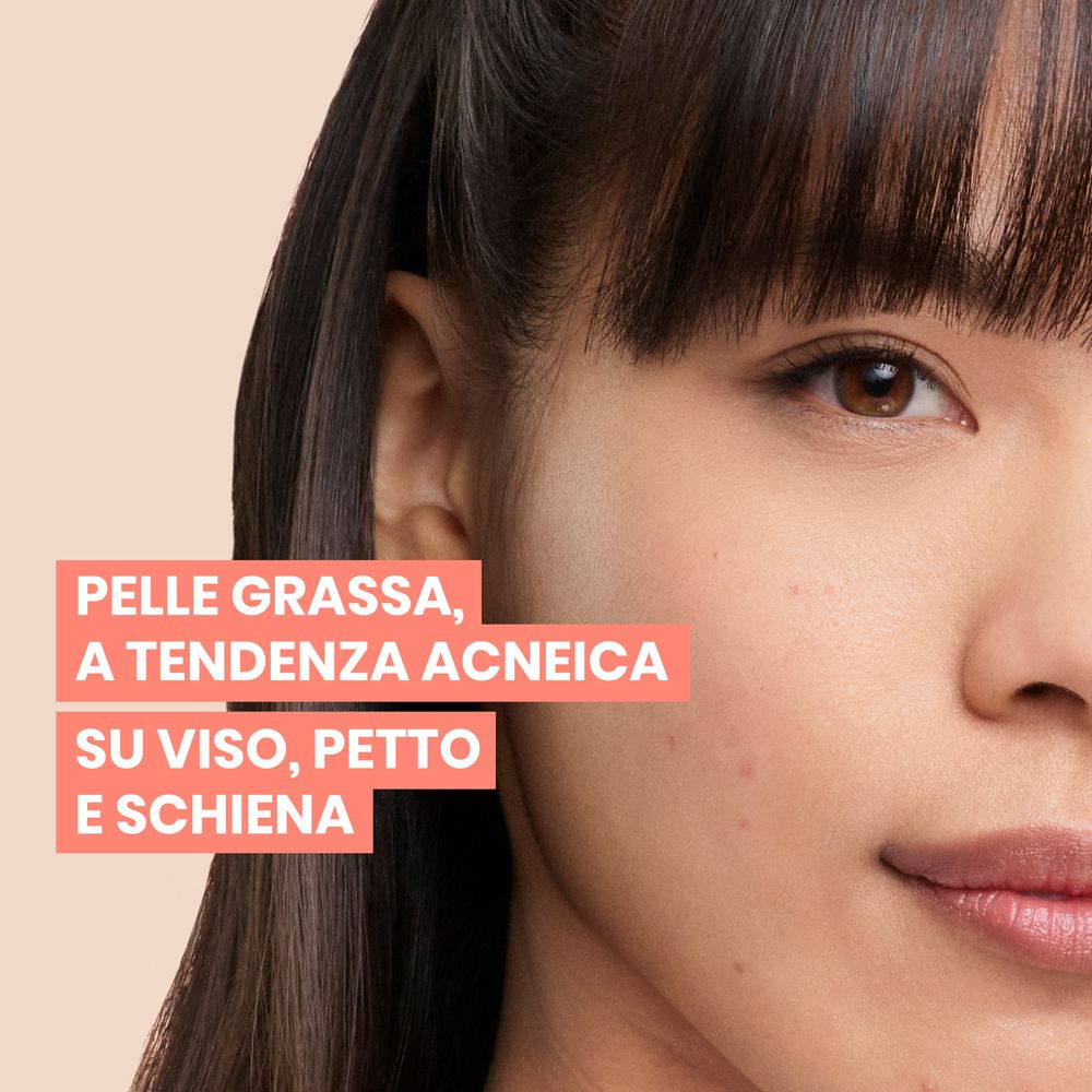 Viso di donna. Testo: Pelle grassa, a tendenza acneica su viso, petto e schiena. Pelle con imperfezioni.