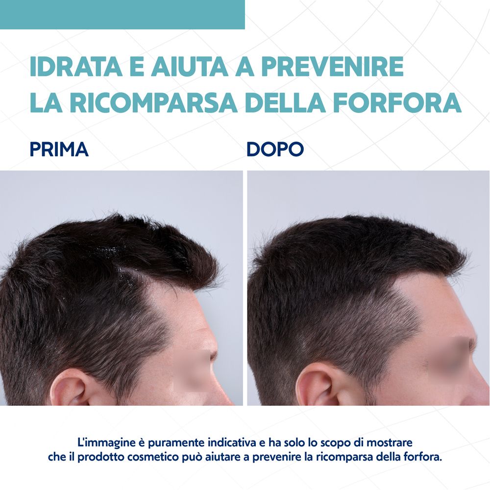 Nizoral Care Shampoo Cute Secca e Sensibile