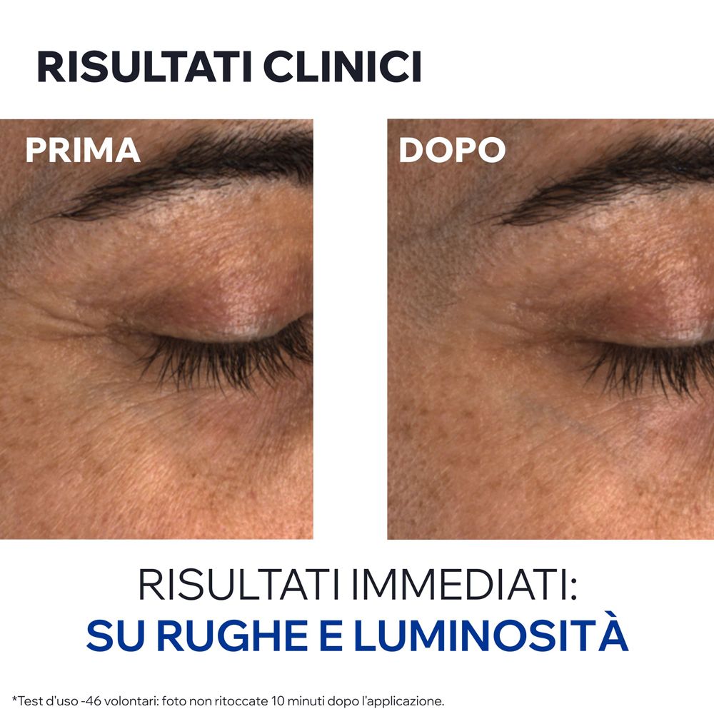 Immagine prima-dopo. Contorno occhi con rughe. Risultati immediati: rughe e luminosità.