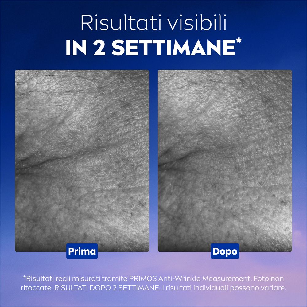 Confronto prima-dopo. Testo: Risultati visibili in 2 settimane. Le foto mostrano la riduzione delle rughe.