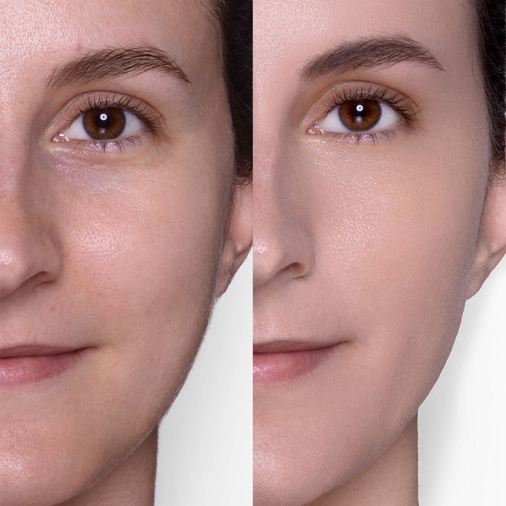 Metà viso prima e dopo l'applicazione del fondotinta. Notevole differenza di incarnato.