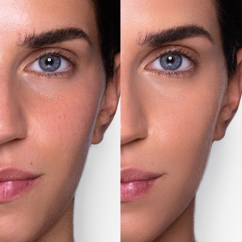 Metà viso con e senza Astra Filter Drop Skin Tint. Sinistra: imperfezioni. Destra: incarnato uniforme.