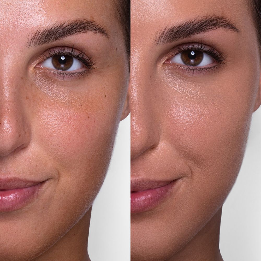 Metà viso prima e dopo l'applicazione del fondotinta. Differenza notevole nell'aspetto della pelle.