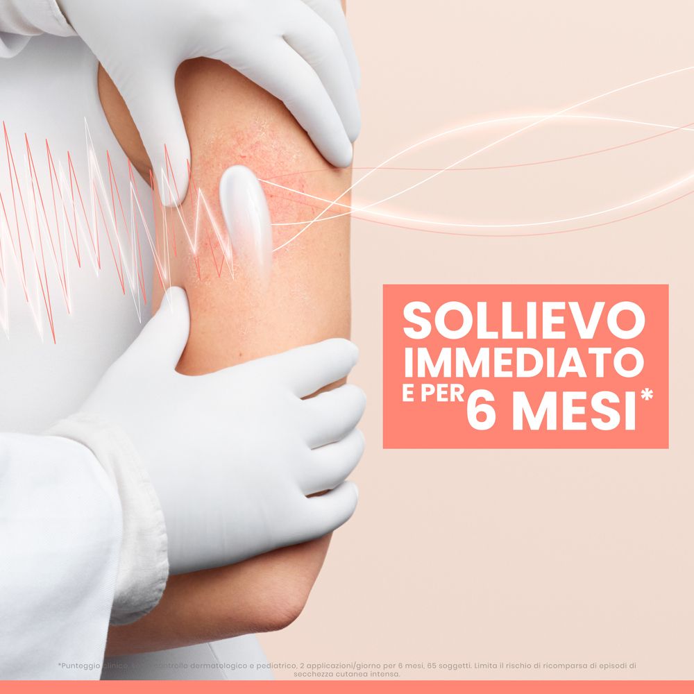 Medico che tratta un braccio con irritazione cutanea con balsamo Avene Xeracalm AD.