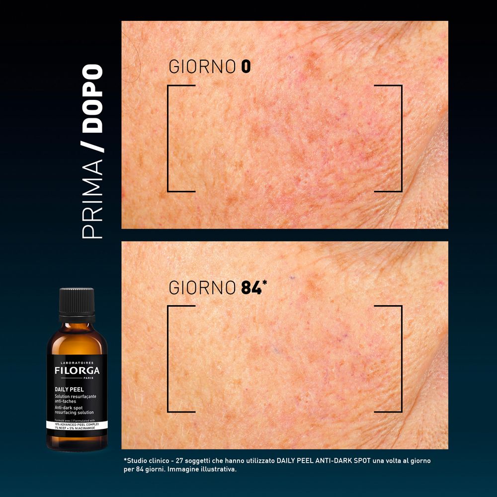 Confronto prima-dopo. Immagini della pelle. Flacone del prodotto. Testo: GIORNO 0, GIORNO 84.