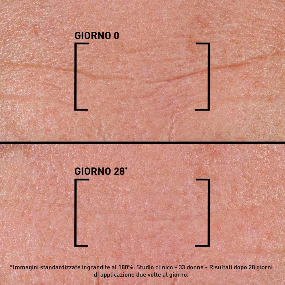 Primo piano della pelle con rughe. Confronto: Giorno 0 e Giorno 28. Testo: Risultati dopo 28 giorni.