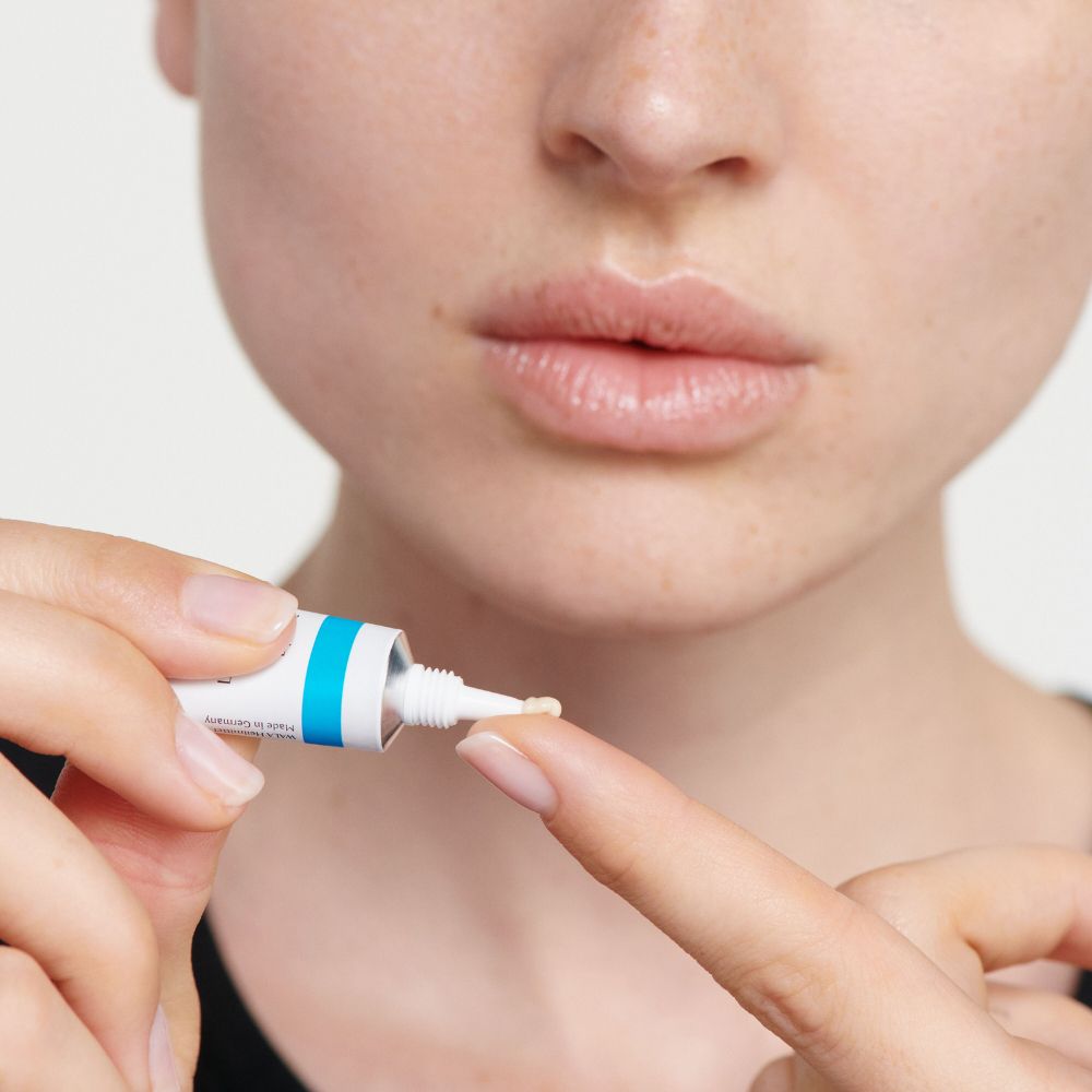 Primo piano di una persona che applica la crema da un tubetto sul dito. Labbra sullo sfondo.