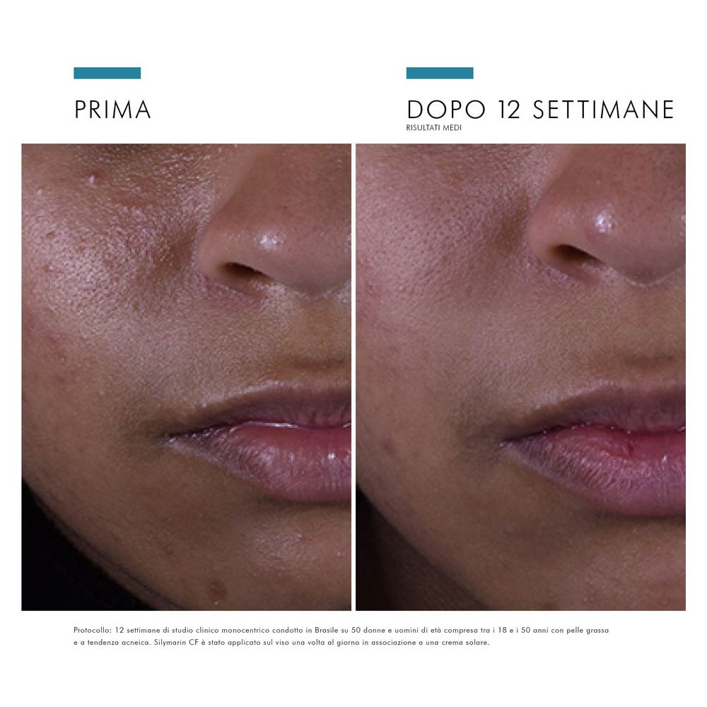 SkinCeuticals Silymarin CF Siero antiossidante con Vitamina C pura ideale per pelli grasse 30 ml