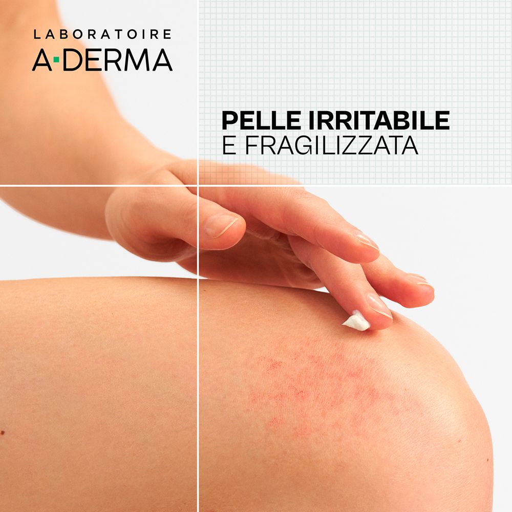 Laboratoire A-Derma: Pelle irritata e fragilizzata. Mano che tocca la pelle con arrossamenti.