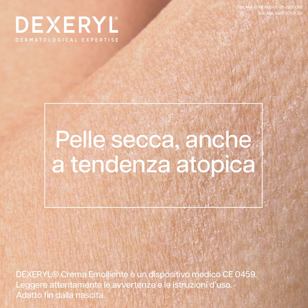 Primo piano di pelle secca, a tendenza atopica.