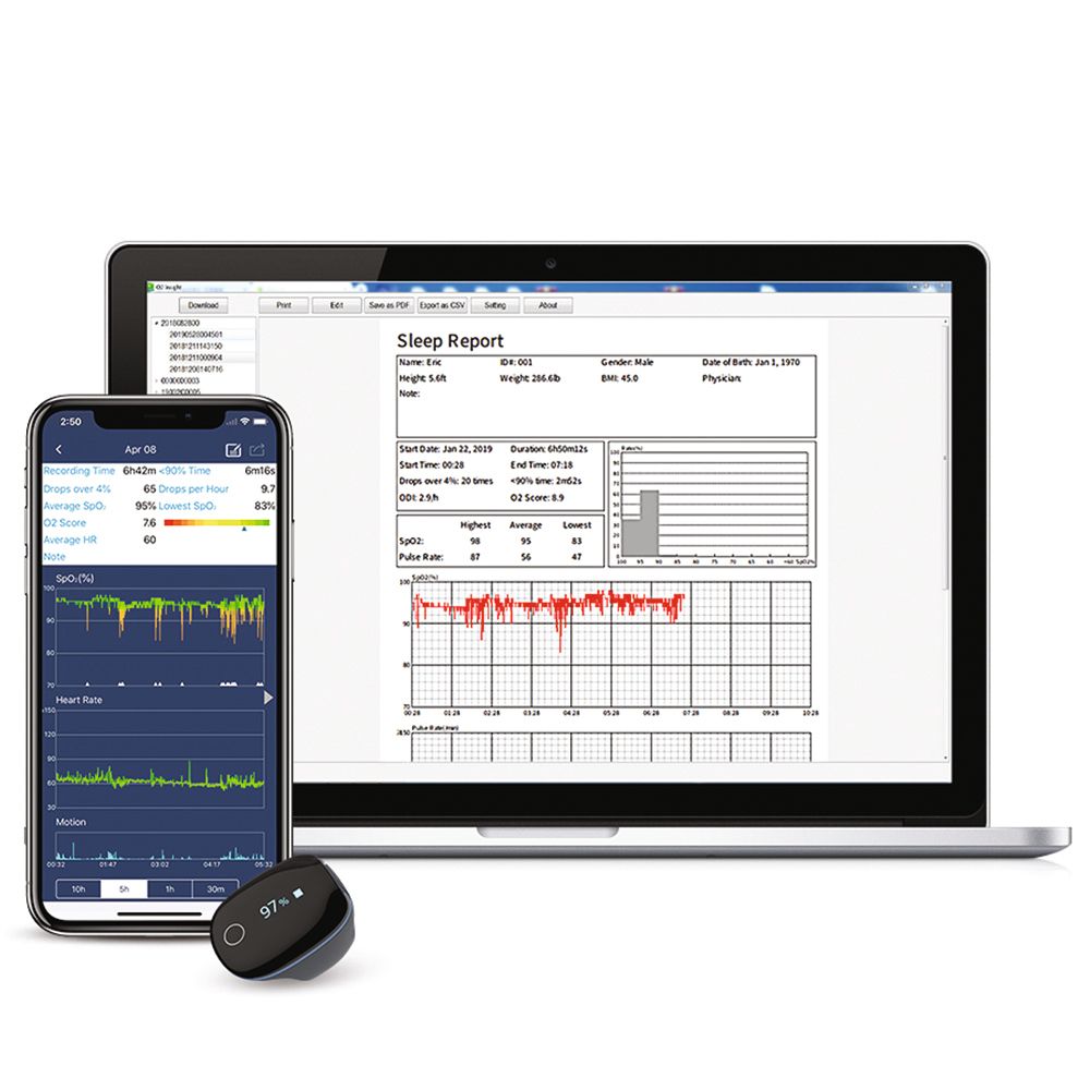 Smartphone, laptop e monitor O2Ring. Laptop mostra analisi del sonno. Smartphone mostra dati. Monitor nero.