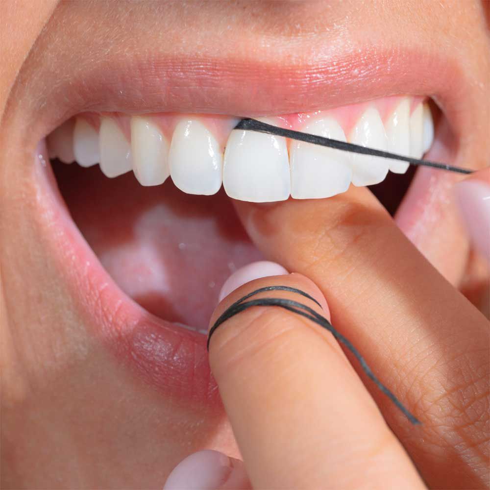 Denti con filo interdentale. Filo nero tra i denti. Mani che tengono le estremità.