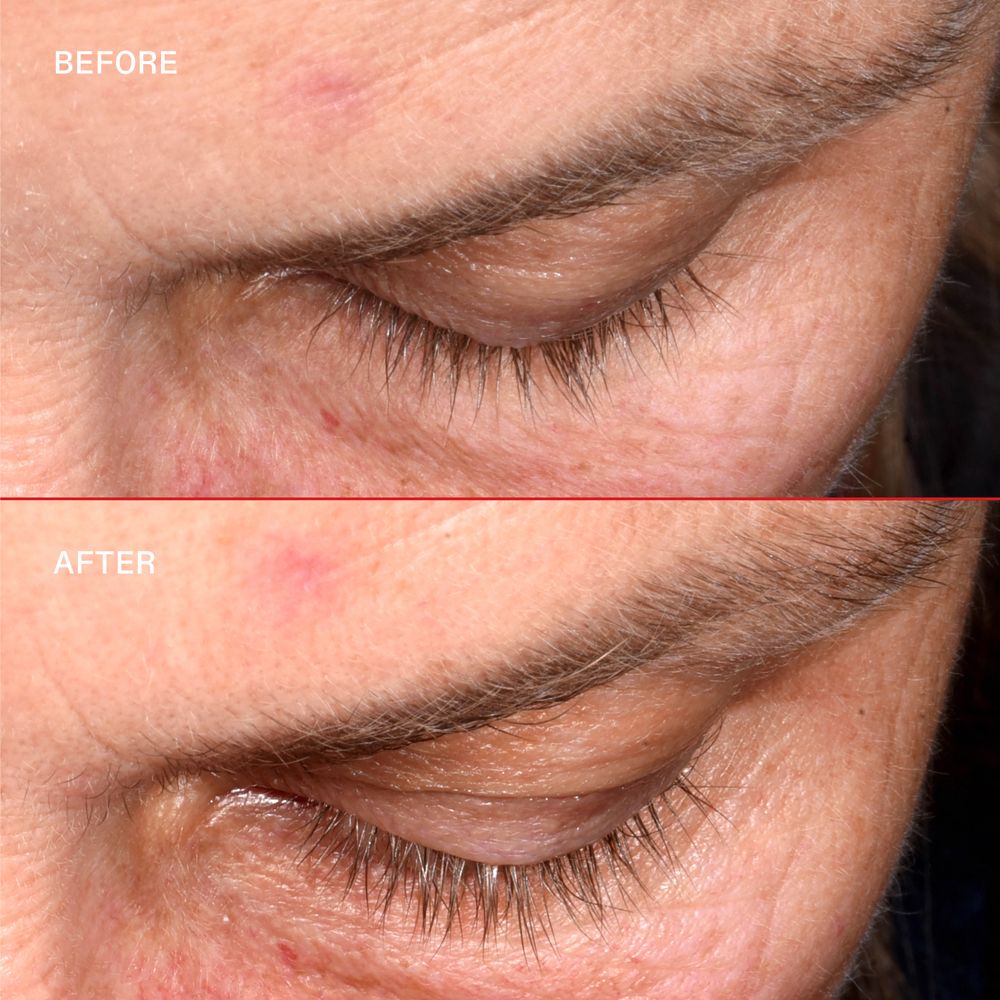 Due primi piani sugli occhi. Sopra: Prima. Sotto: Dopo. Le ciglia sono più lunghe.