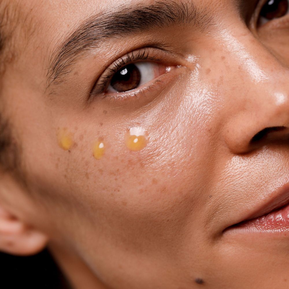 Primo piano di un viso con gocce gialle sulla pelle. Pelle con lentiggini.