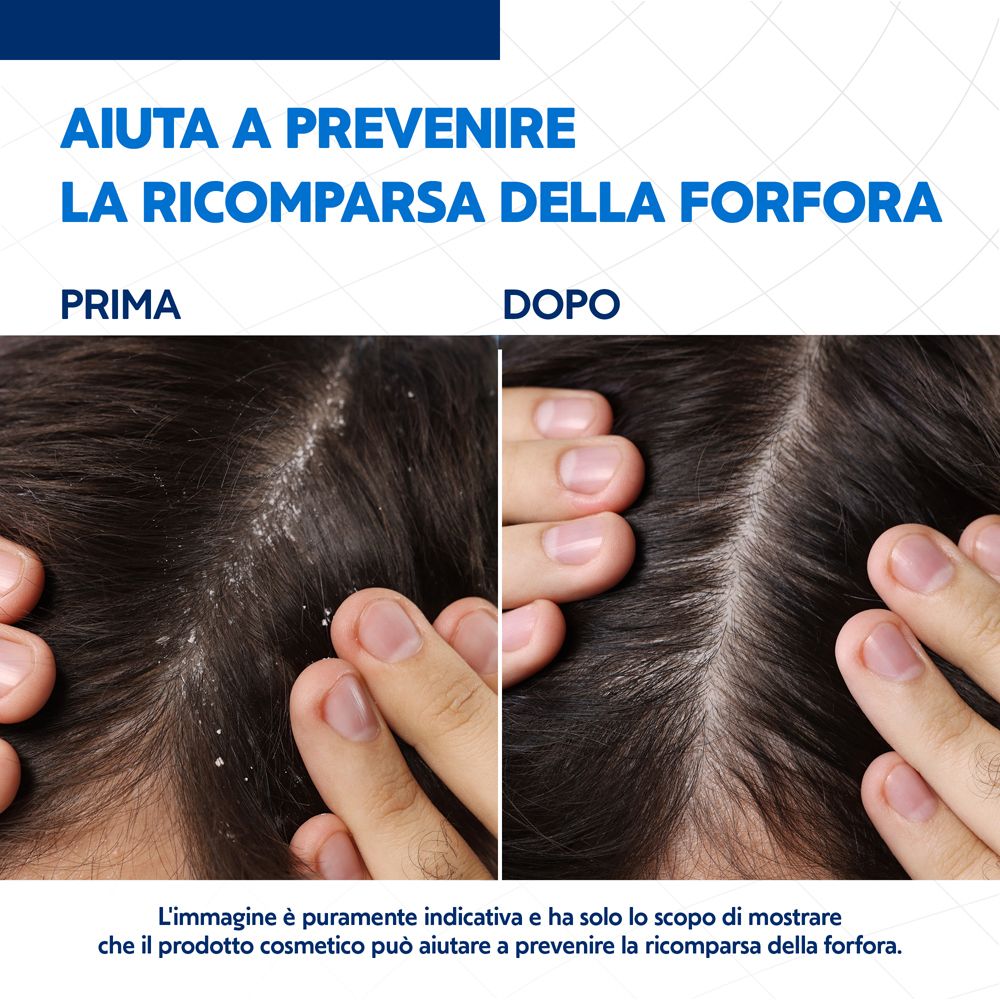 Confronto prima-dopo del cuoio capelluto con forfora. Testo: Aiuta a prevenire la ricomparsa della forfora.