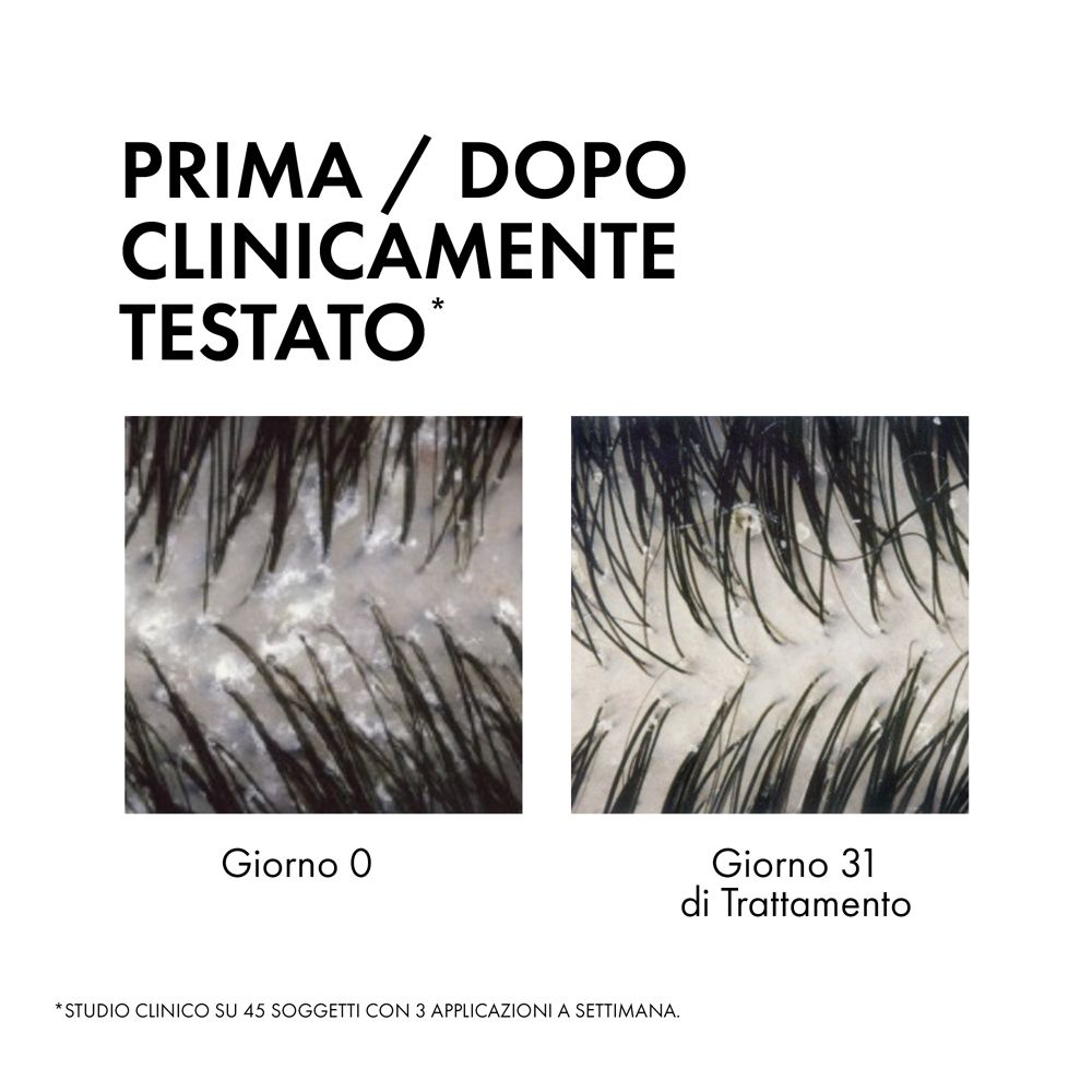 Dercos Anti-Forfora DS 2 In 1 Balsamo Shampoo