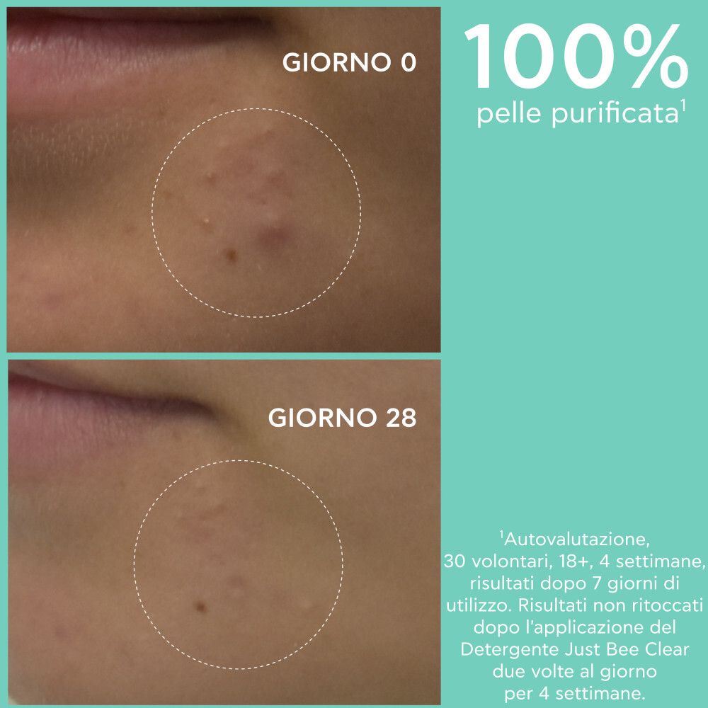 Confronto pelle. Prima/Dopo. Testo: Giorno 0, Giorno 28. 100% pelle purificata.