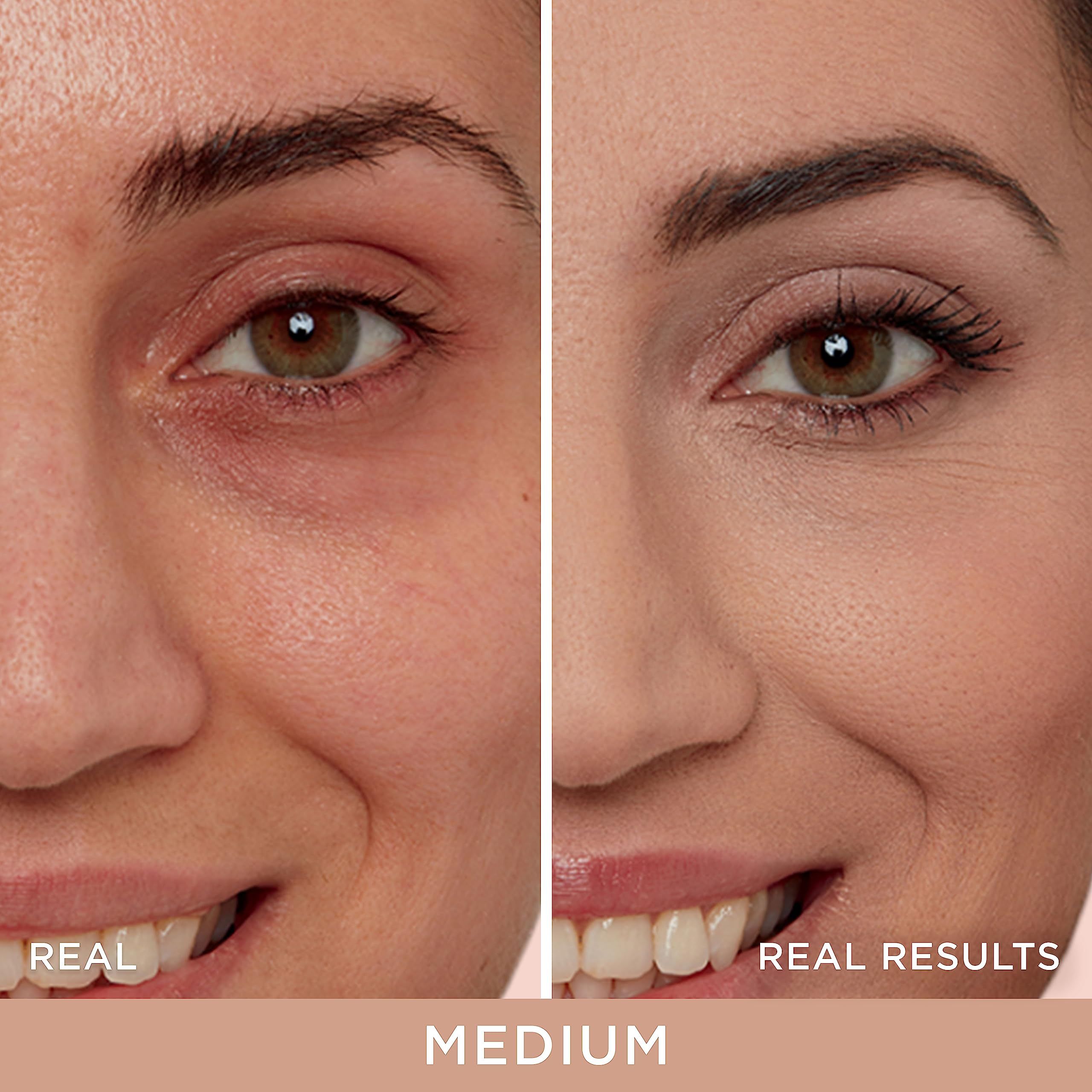 Confronto prima-dopo di un viso. Lato sinistro: Prima. Lato destro: Dopo. Testo: Real Results. Tonalità: Medium.