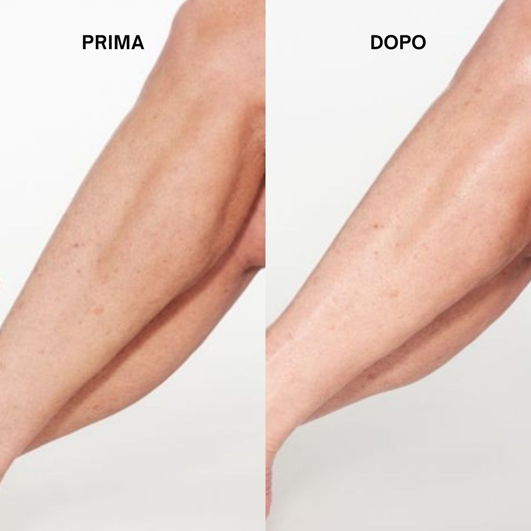 Gambe prima e dopo l'uso. La pelle appare più liscia e idratata.