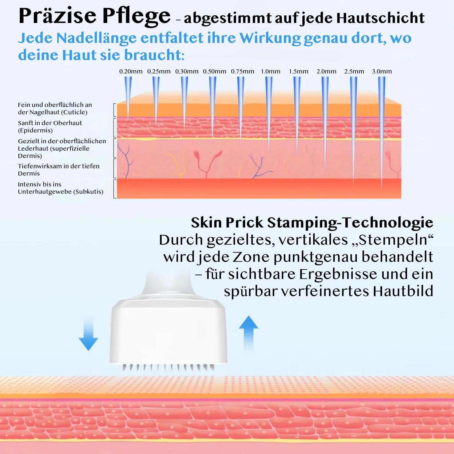 Illustrazione che mostra strati di pelle e lunghezze di aghi da 0,2mm a 3,0mm. Spiega la tecnologia Skin Prick Stamping.
