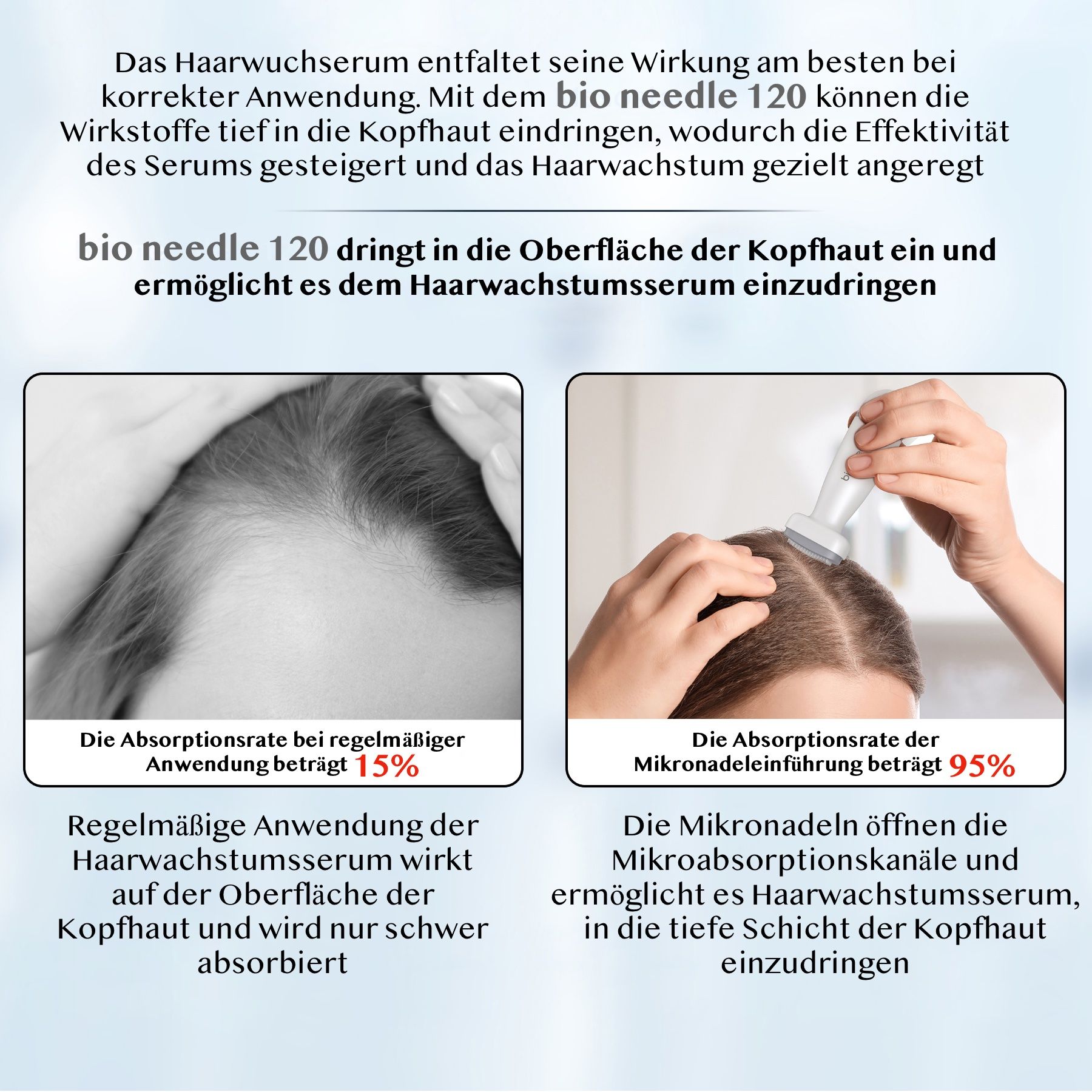 Derma Stamp Dermapen Mesoroller 120 aghi in acciaio inossidabile