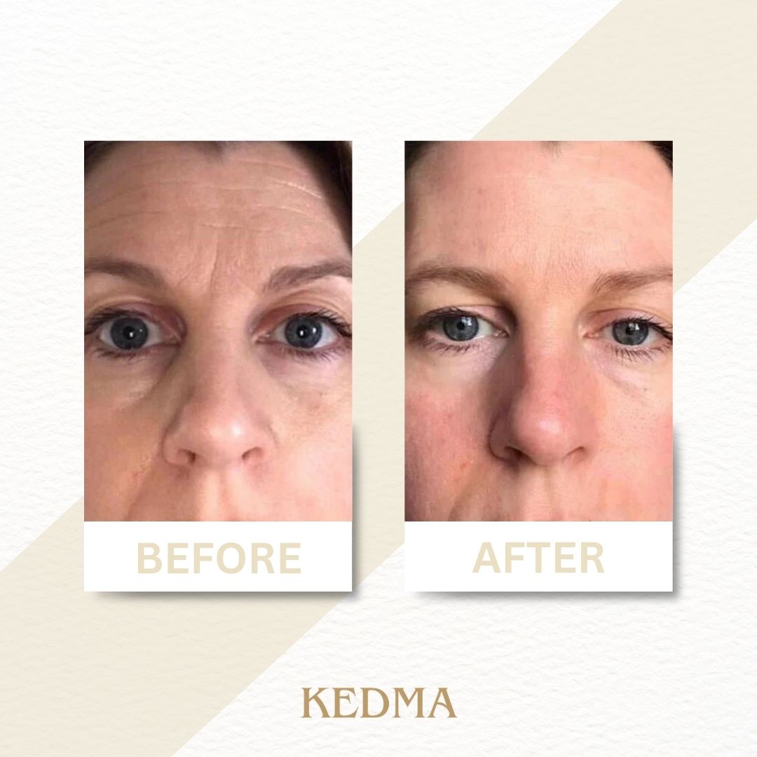Kedma - Booster Siero con Collagene Marino e Minerali del Mar Morto
