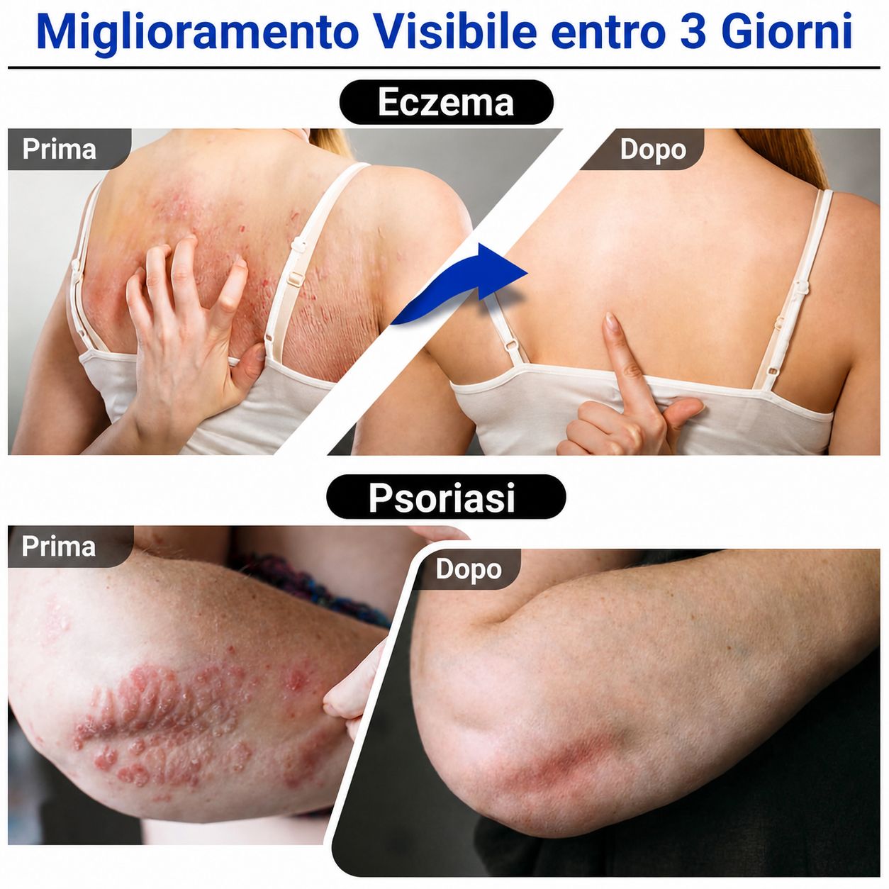 LMNOOP crema per eczema